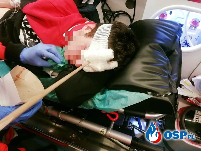 16-latek został postrzelony z łuku w głowę. Kolega "chciał go tylko przestraszyć". OSP Ochotnicza Straż Pożarna
